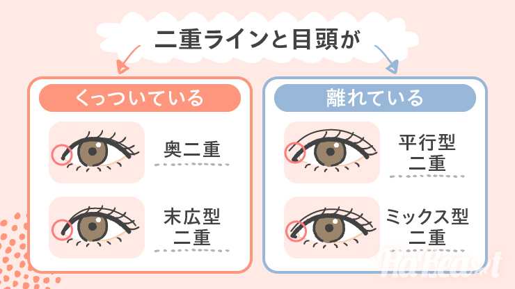 二重の種類紹介